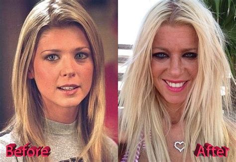 tara reid plastic surgery|Tara Reid Feels ‘Great’ After Getting a Smile Makeover